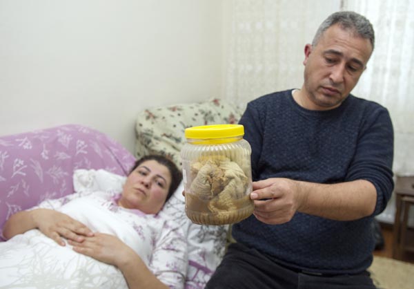 Kanser Diye Amaliyata Girdi İçinden Gazlı Bez Çıktı!