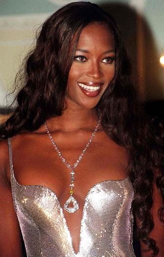 Naomi Campbell Germobofik rahatsızlığı ile şaşkına çevirdi