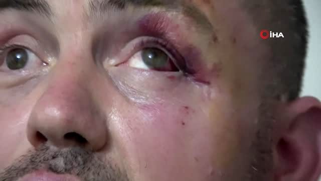 Yüzde 92 engelli gaziyi, ayaklarını uzattığı için dövdüler!