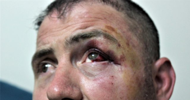 Yüzde 92 engelli gaziyi, ayaklarını uzattığı için dövdüler!