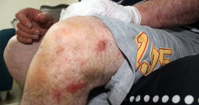 Yüzde 92 engelli gaziyi, ayaklarını uzattığı için dövdüler!