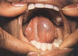 Sınıfta bir anda yere yığılan ilkokul öğrencisi hayatını kaybetti