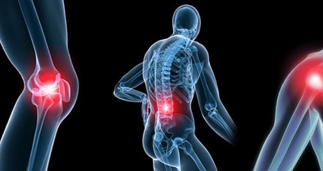 Sadece 1 Ay İçinde Romatizma Ağrılarını Geçiriyor