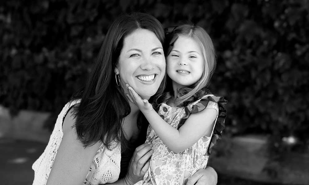 Down sendromu nedir? | Down sendromu genetik mi?