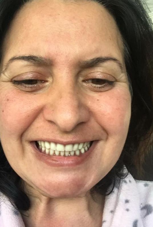 Dişleri yüzünden ötenazi istemişti! Şimdi ise gülücükler saçıyor