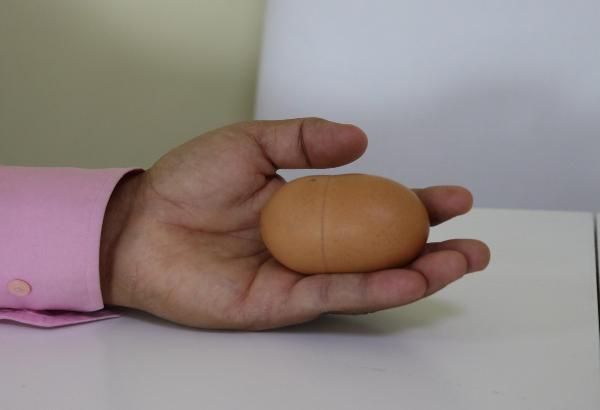 1 yumurtaya 100 lira verdi