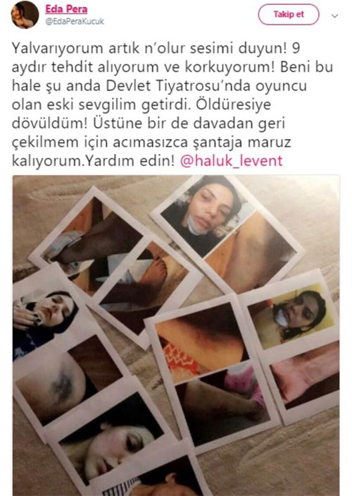 Eda Pera Küçük Kimdir | Kim Tarafından Darp Edildi