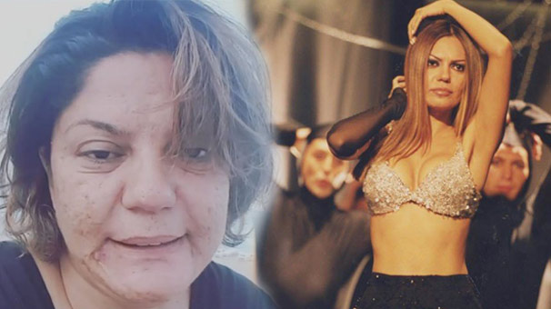 İzel'in son hali | Şarkıcı İzel'in yüzüne ne oldu?