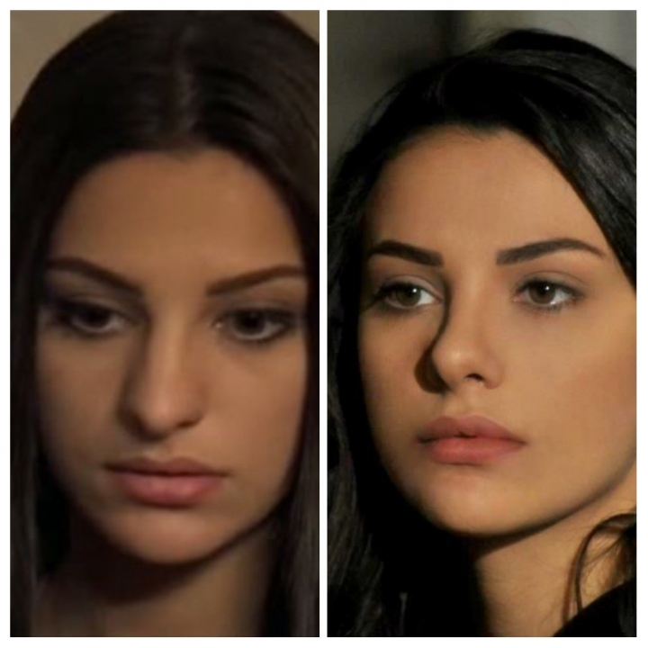 Tuvana Türkay kimdir? Estetiksiz hali| Tuvana Türkay'ın annesiyle öpüşme görüntüleri