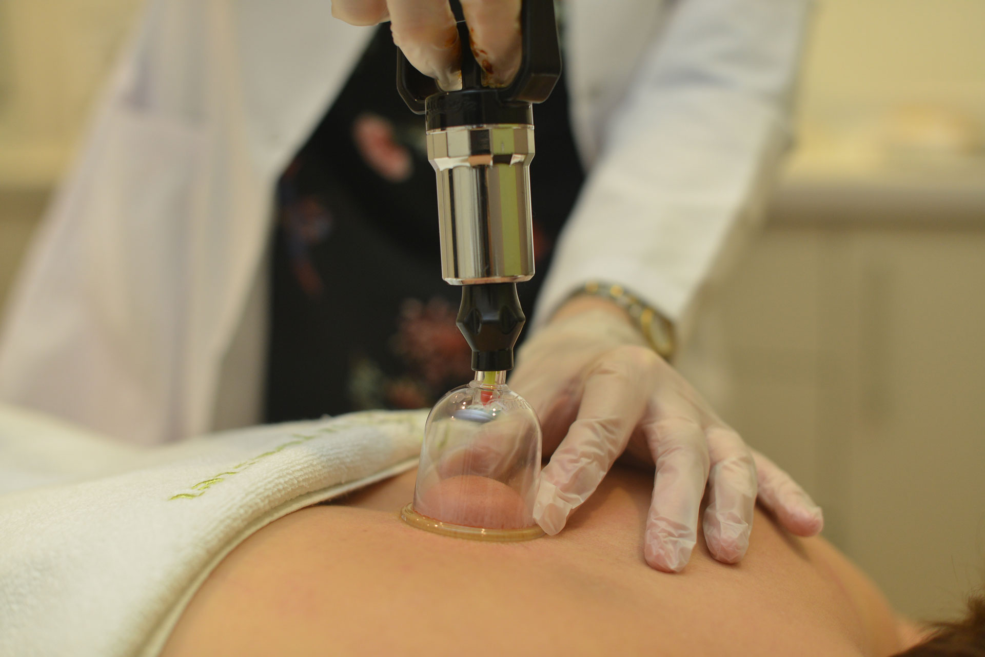 Hacamat nedir? Nasıl yapılır? Faydaları nelerdir? Zararları nelerdir?