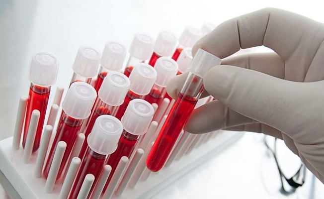 Hemofili Nedir, Belirtileri Nelerdir, Nasıl Tedavi Edilir | 17 Nisan Dünya Hemofili Günü 