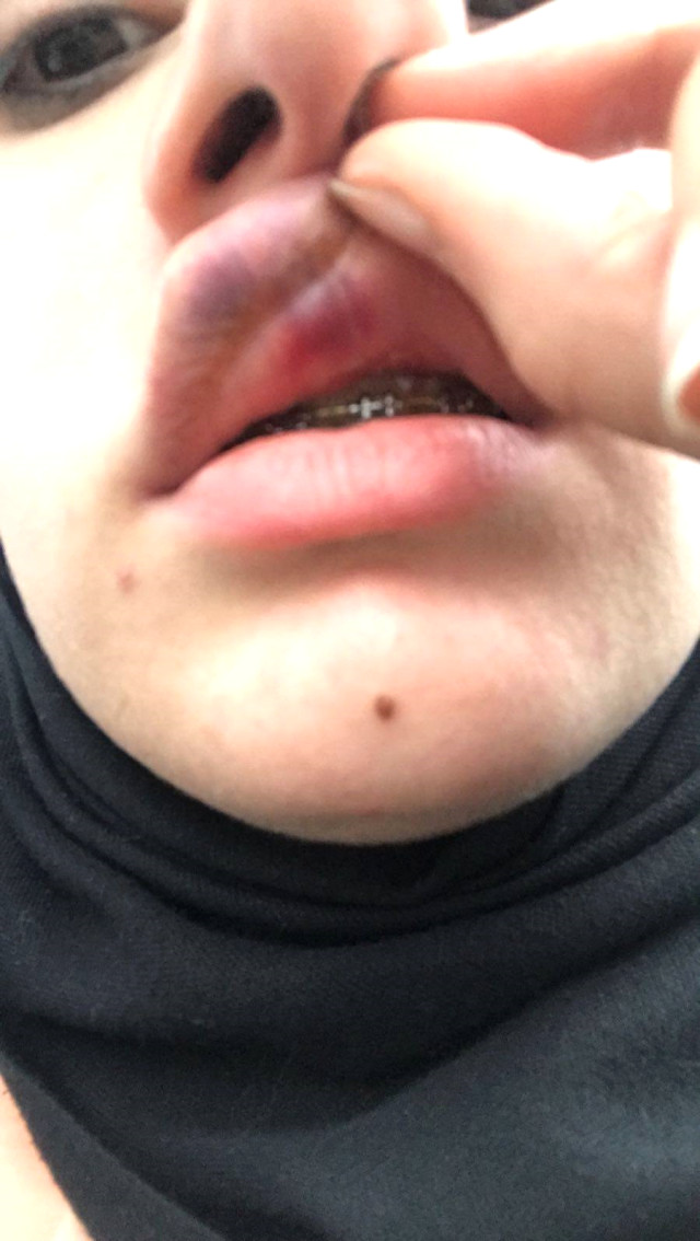 Yusuf Akkuş Kimdir | Elif Kübra Genç'i Neden Darp Etti