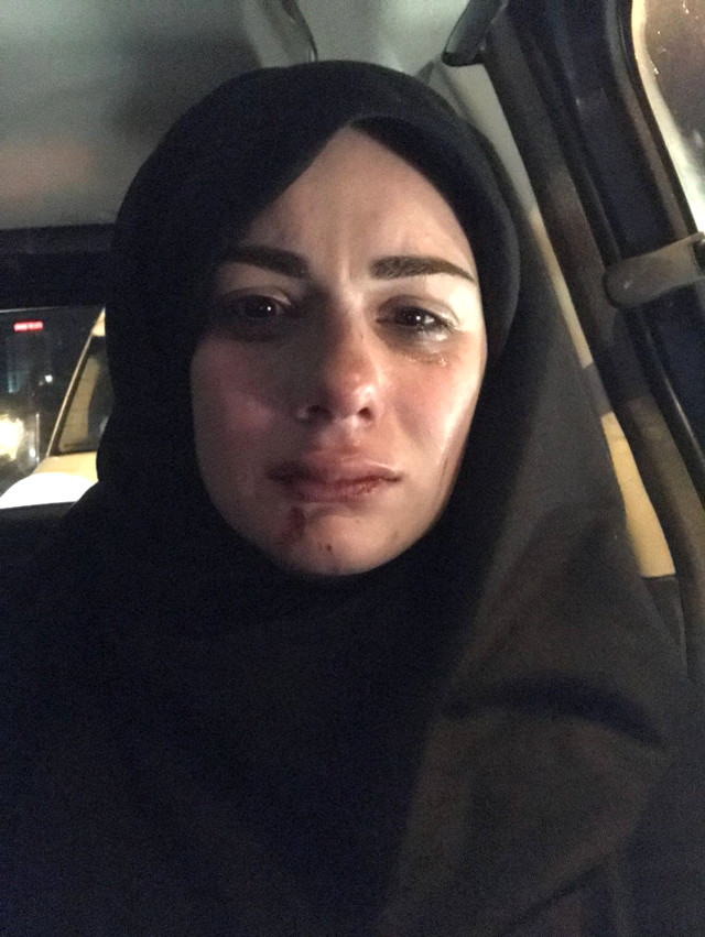 Yusuf Akkuş Kimdir | Elif Kübra Genç'i Neden Darp Etti