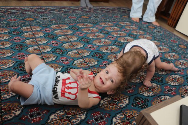 Kafaları yapışık siyam ikizleri 1 yaşına bastı!