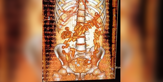 Atatürk Havalimanı'nda yolcunun midesinde uyuşturucu bulundu