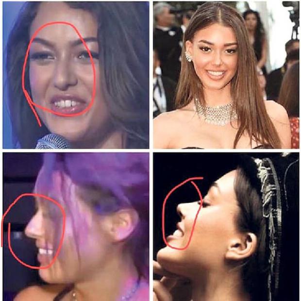 Dilan Çiçek Deniz kimdir? Aslen nereli? Kaç yaşında? Estetiksiz hali