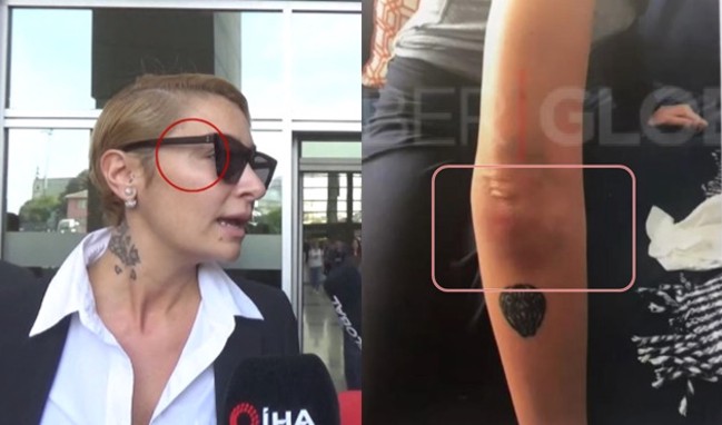 Sıla'nın darp raporu ortaya çıktı!