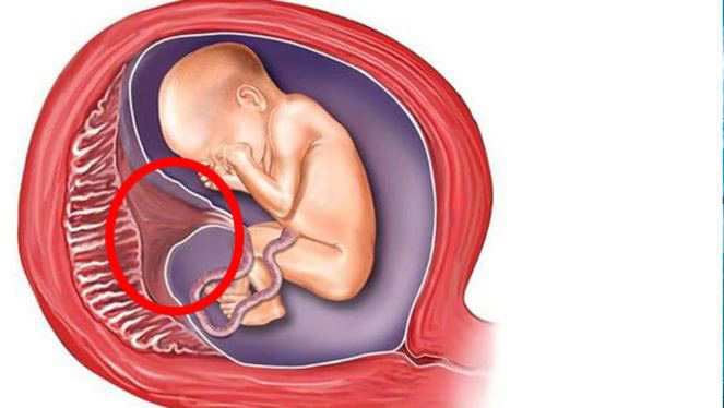 Plasenta nedir? Plasenta yenir mi? Güzellik için plasenta yeme akımı Türkiye'de!