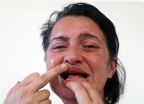 Dişleri yüzünden ötenazi istemişti! Şimdi ise gülücükler saçıyor