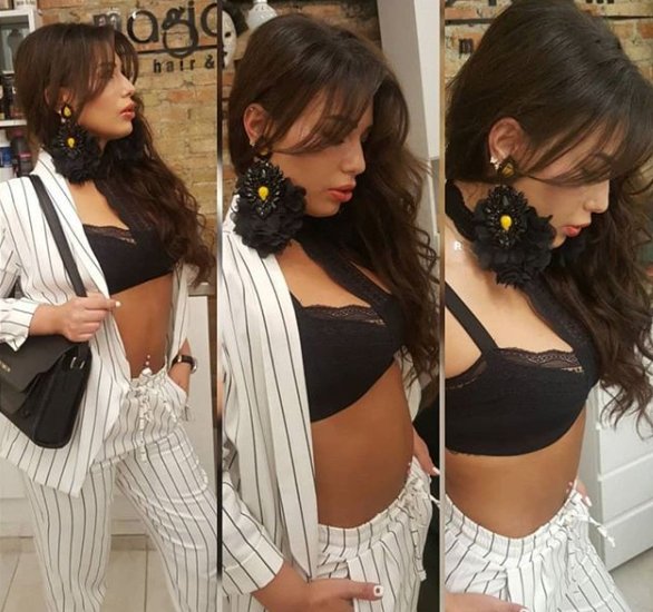 Güllü Köse 22 kez estetik ameliyatı oldu