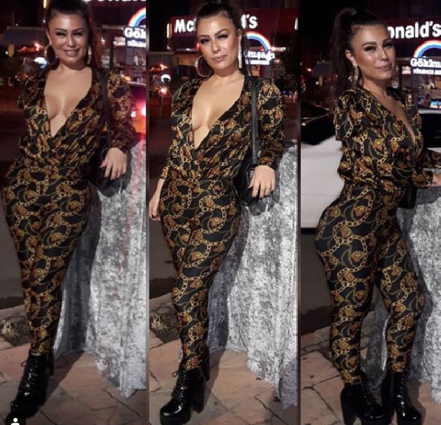 Güllü Köse 22 kez estetik ameliyatı oldu