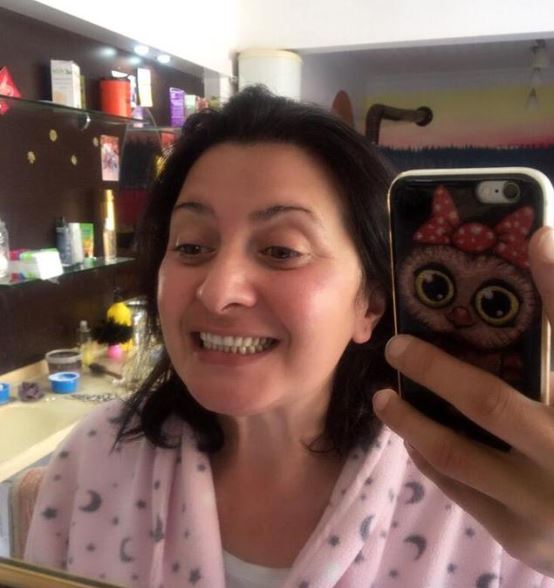 Dişleri yüzünden ötenazi istemişti! Şimdi ise gülücükler saçıyor