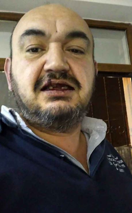 On Kişi UBER Şoförünü Darp Edip Dişlerini Kırdılar