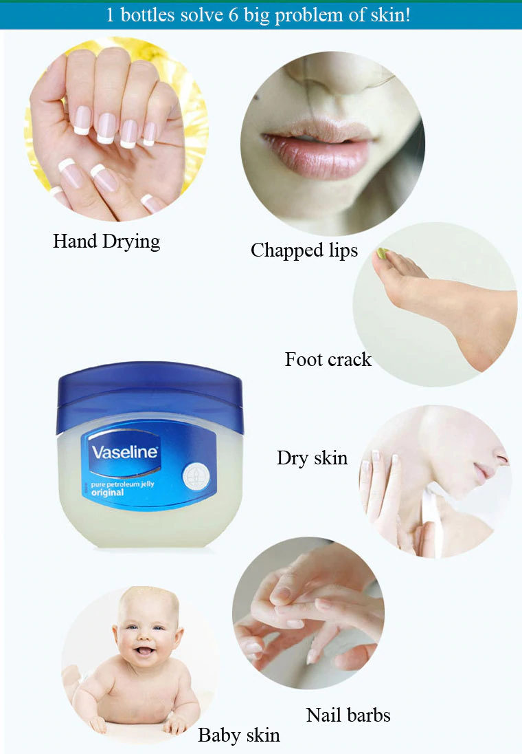 Vazelinin faydaları nelerdir? Nerelerde kullanılır? Vazelinin farklı kullanım alanları